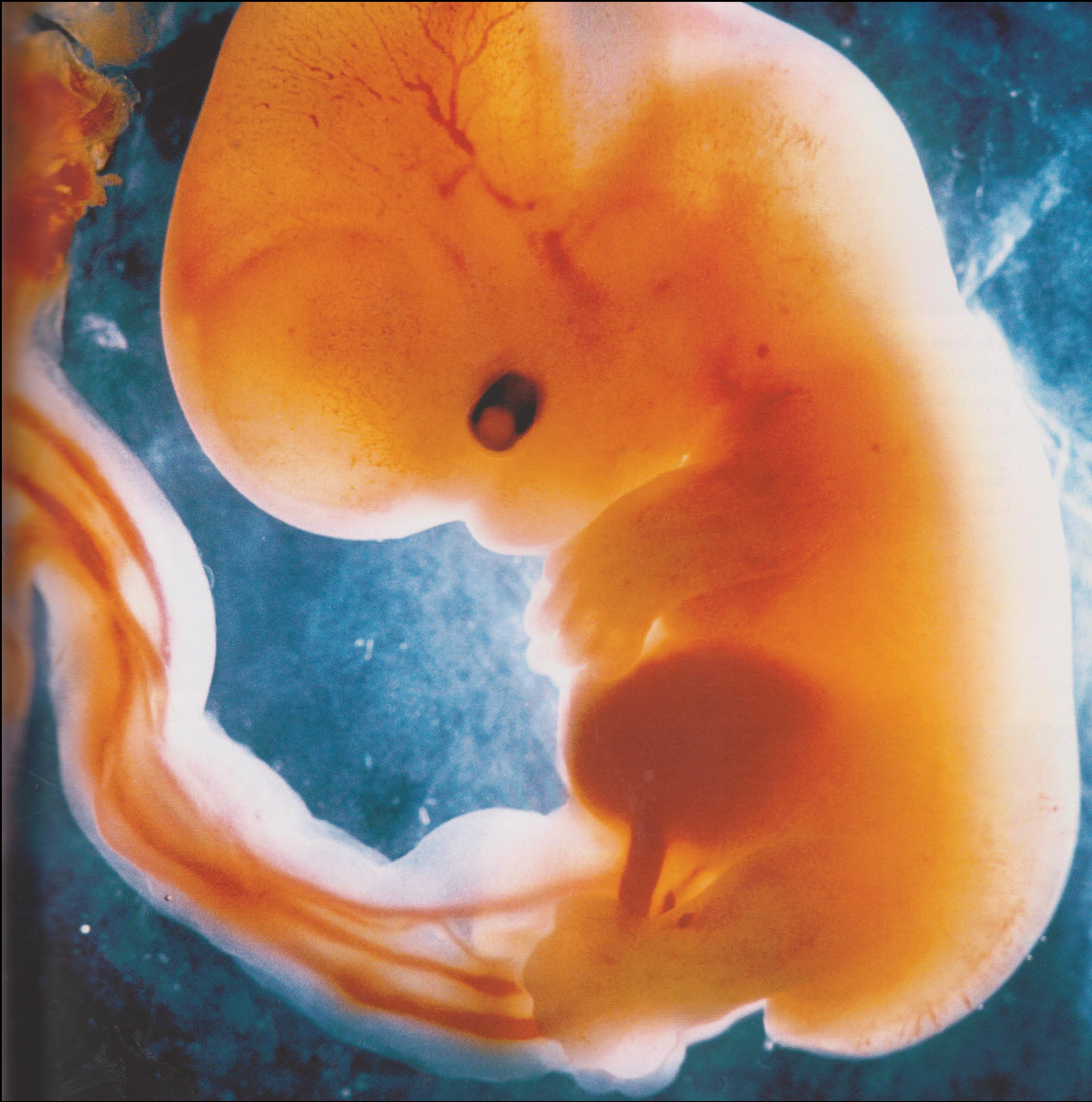 Human being at 6 weeks from fertilization